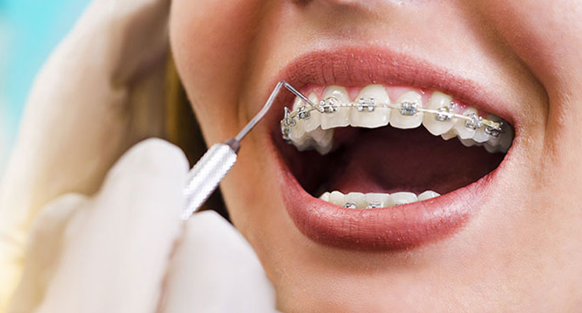 orthodontic experts