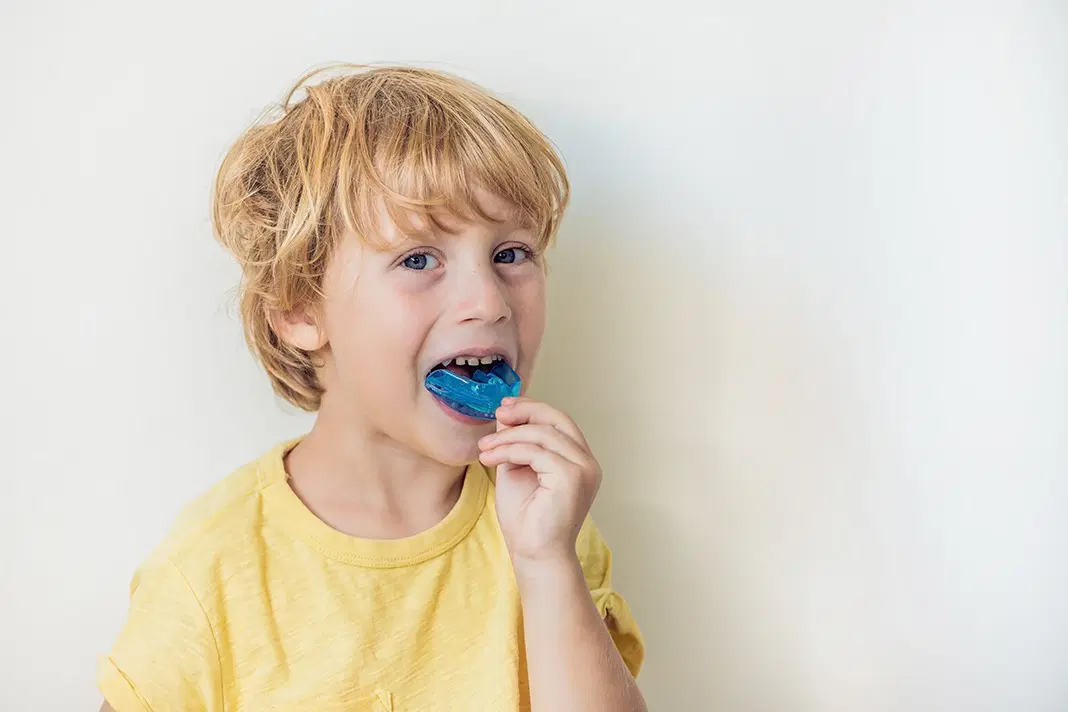 mouth guard