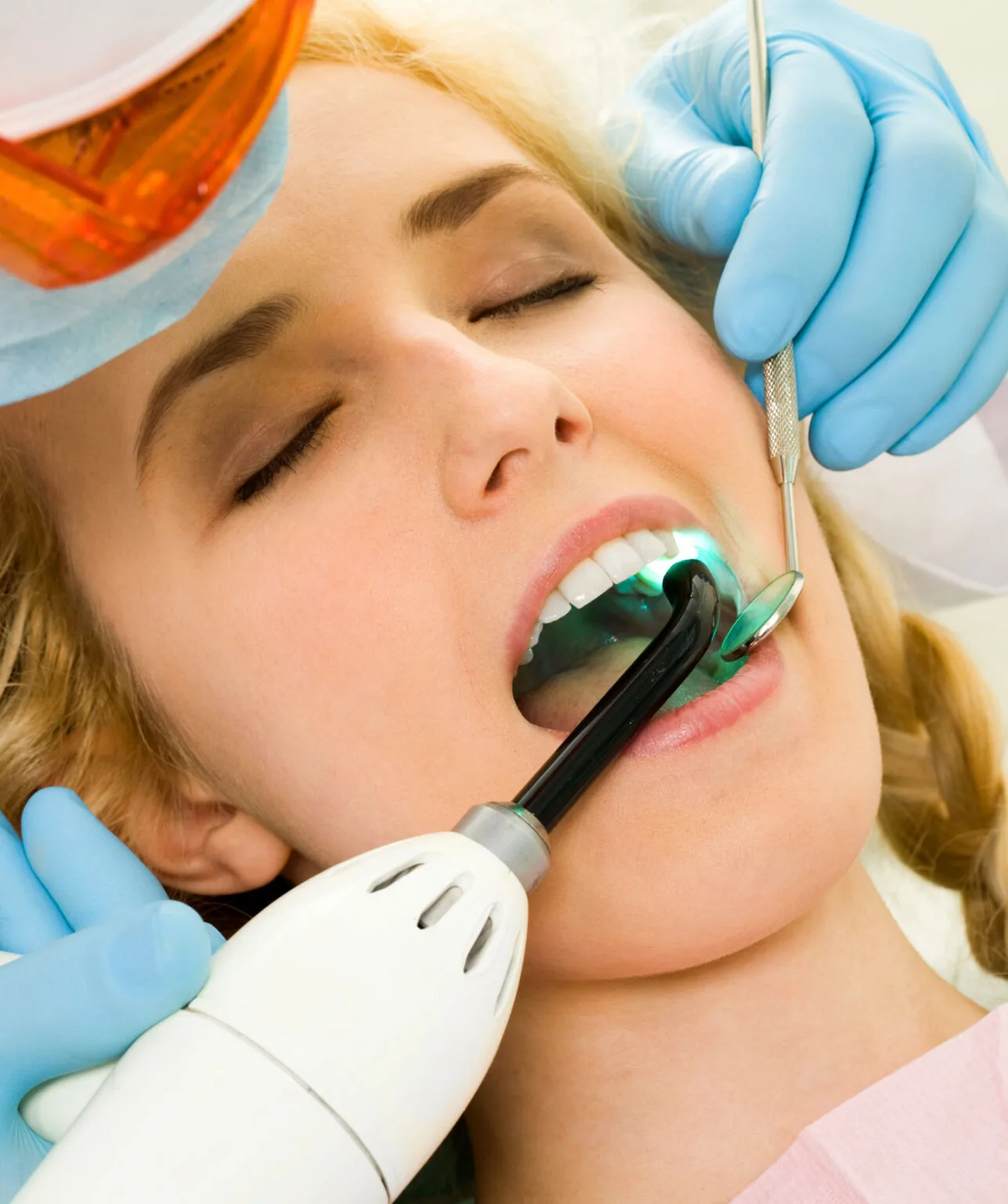 best veneers houston