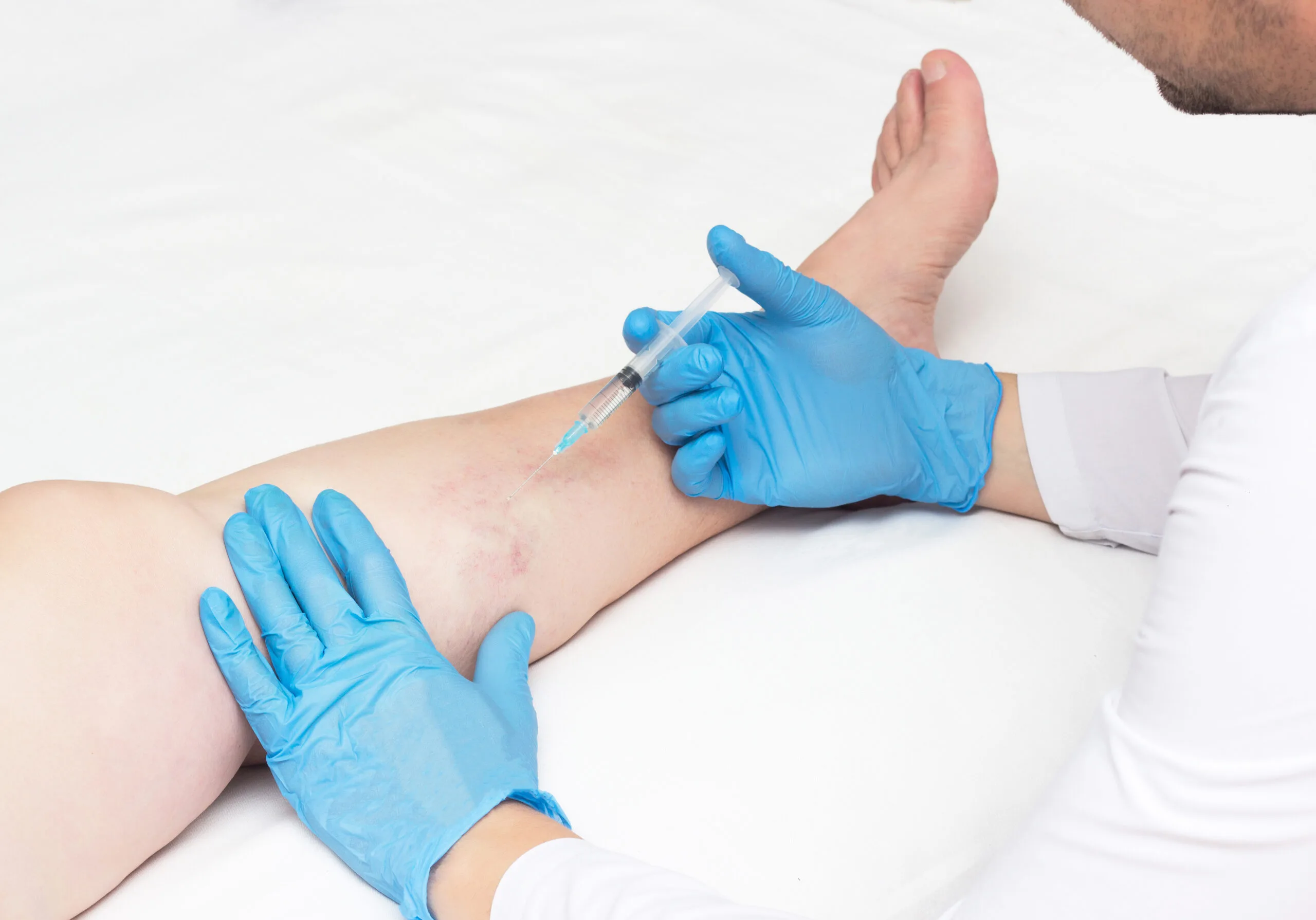 spider vein doctor NYC
