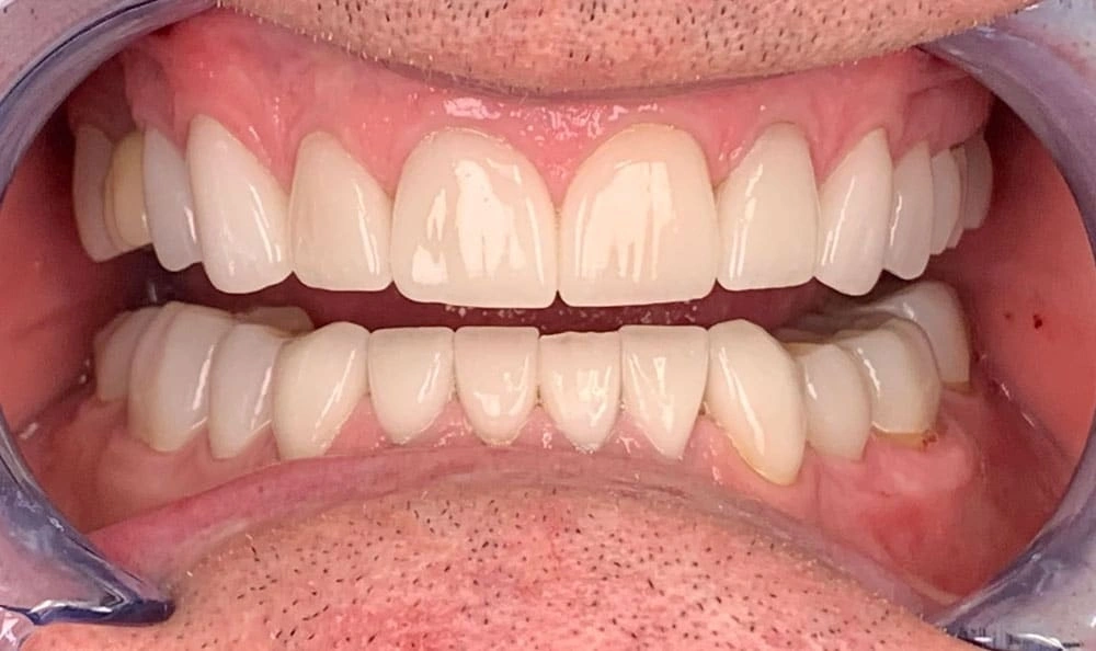 root canal emergency near me