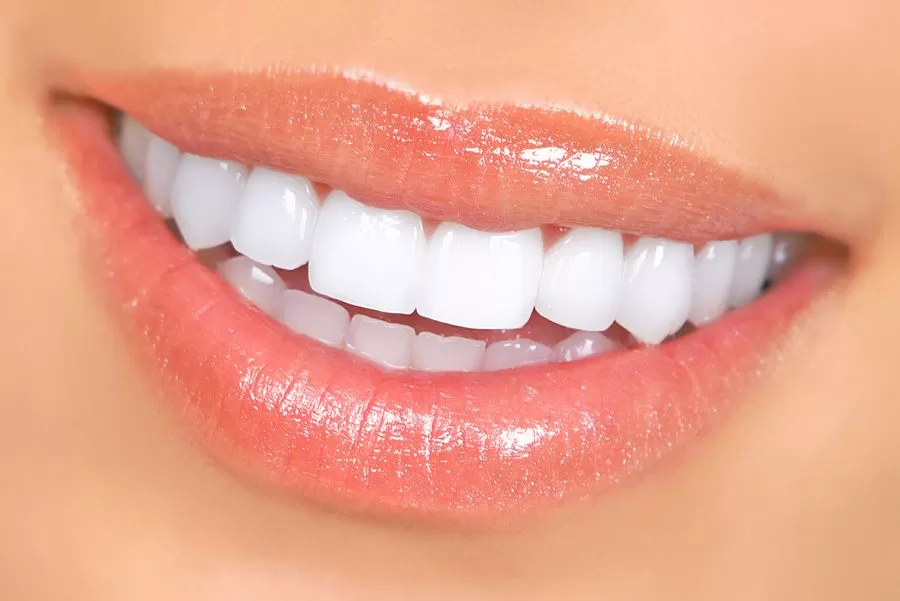 straight white teeth