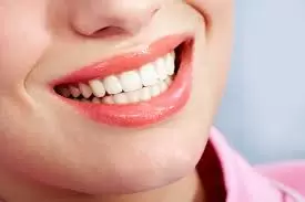 teeth whitening houston