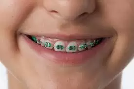 dark green braces