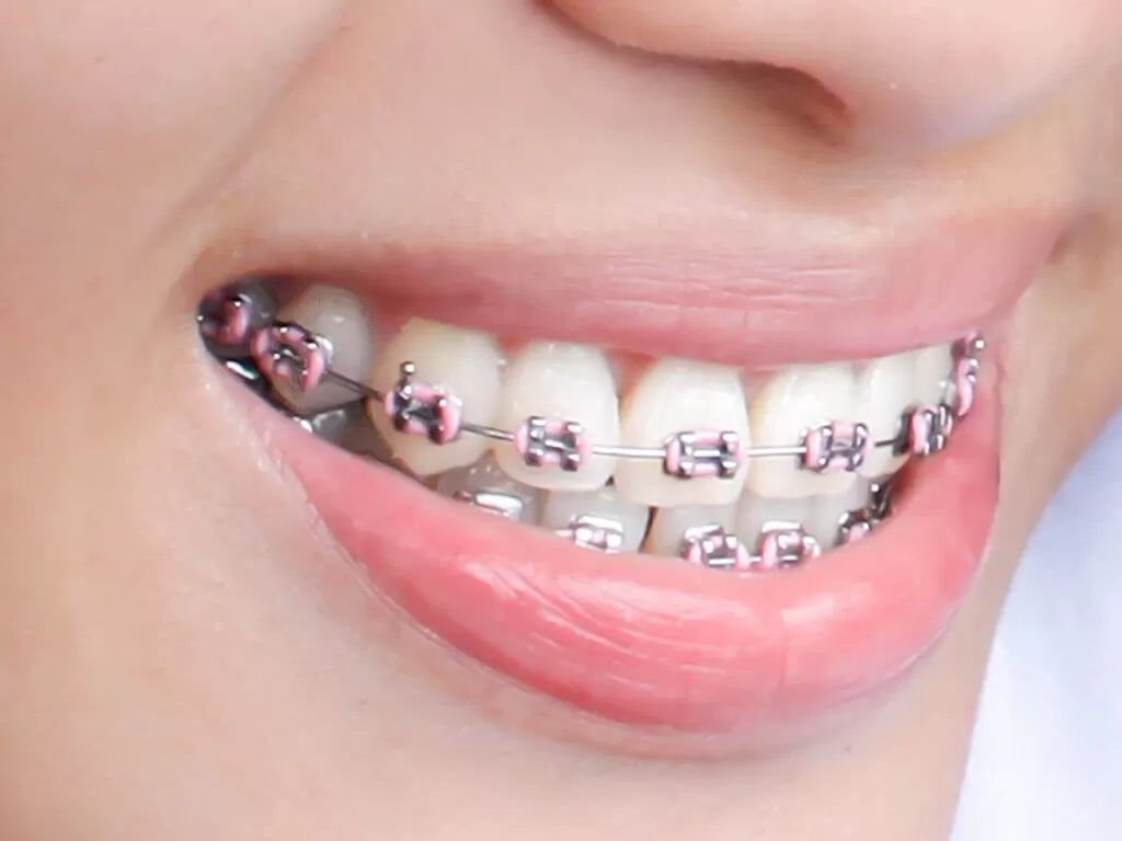 orthodontists miami fl