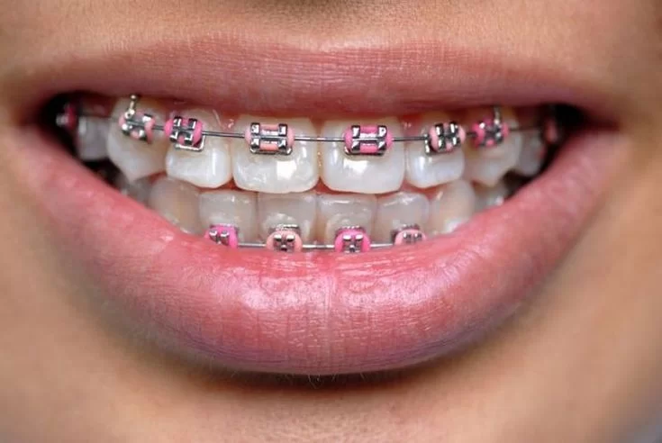 orthodontist for adults near me